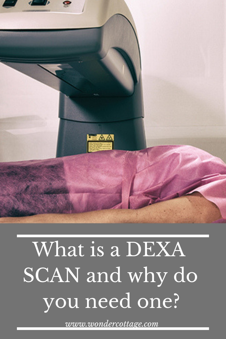 what is dexa scan?