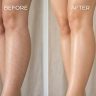8 Natural Ways to Get Rid of Strawberry Legs