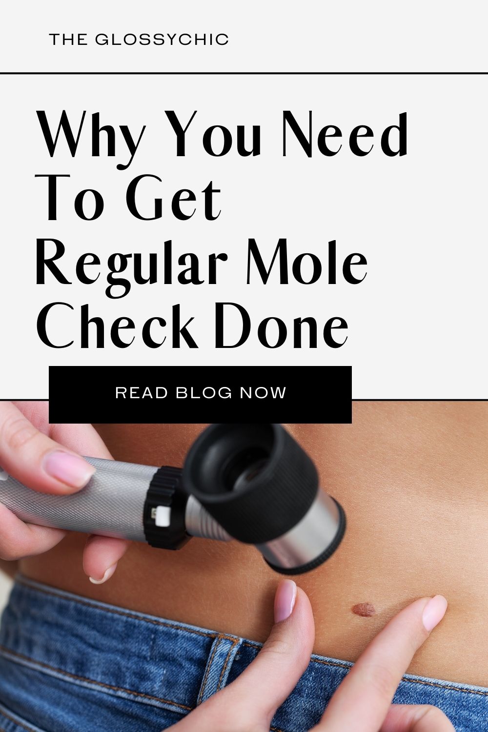 Why Do You Need To Get The Regular Mole Check Done?