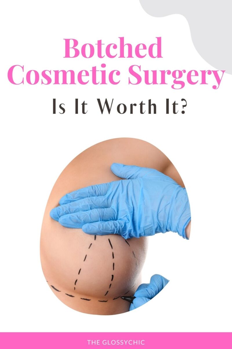 Is It Worth Going Under The Knife? 3 Examples of Botched Cosmetic ...