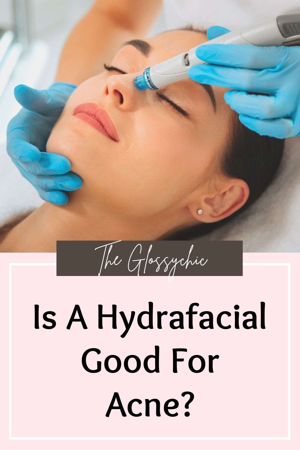 Is A Hydrafacial Good For Acne?