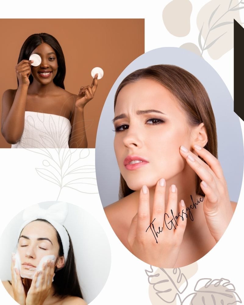 oily face How to get rid of oily skin